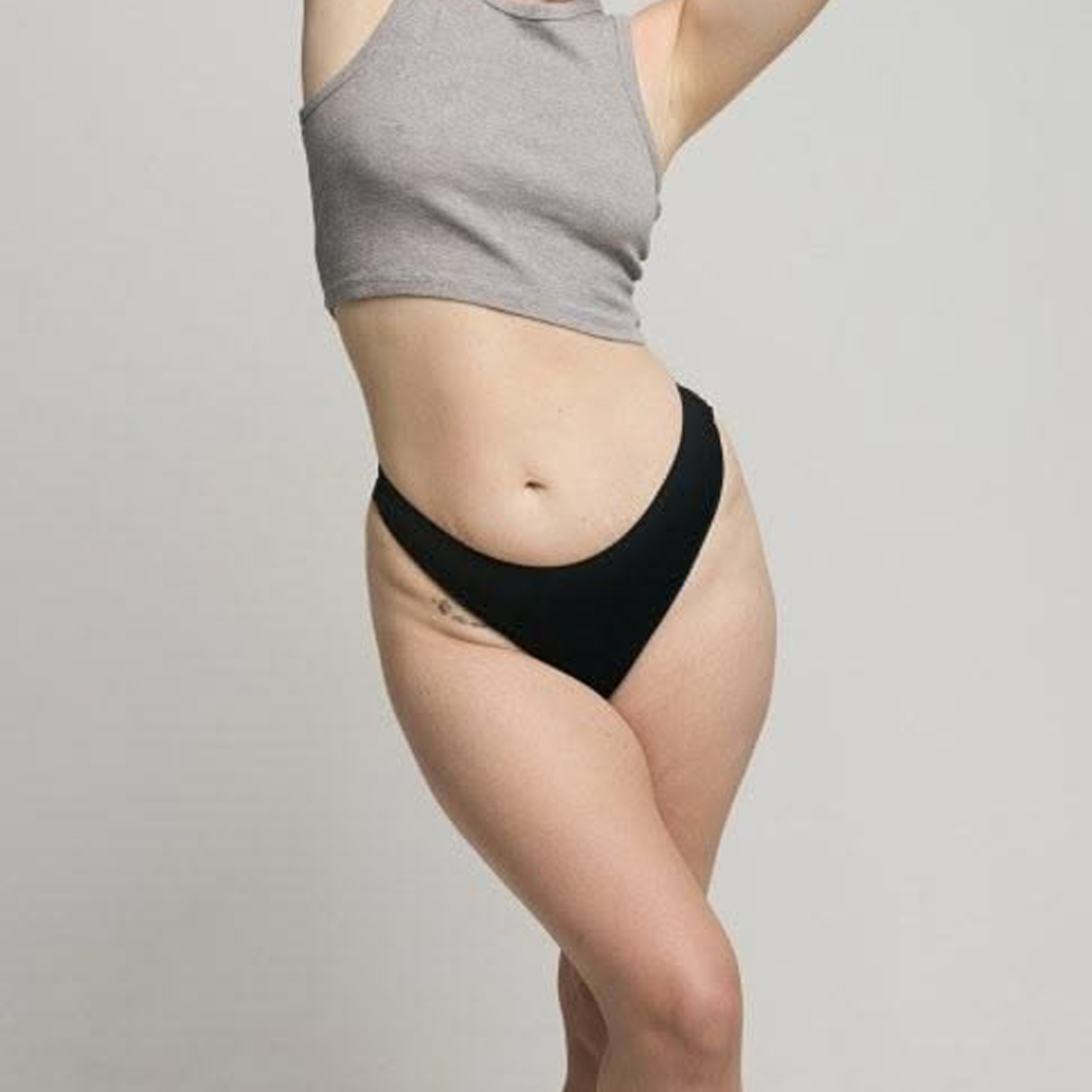 Liposuction (Liposculpture) — SANTELLY Surgical Concierge